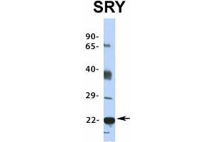 Host:  Rabbit  Target Name:  SRY  Sample Type:  HepG2  Antibody Dilution:  1. (SRY anticorps  (Middle Region))