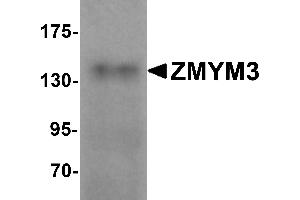 Western Blotting (WB) image for anti-Zinc Finger Protein 261 (ZMYM3) (C-Term) antibody (ABIN1030826) (ZMYM3 anticorps  (C-Term))