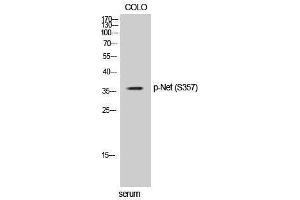 Western Blotting (WB) image for anti-ELK3, ETS-Domain Protein (SRF Accessory Protein 2) (ELK3) (pSer357) antibody (ABIN3182797) (ELK3 anticorps  (pSer357))