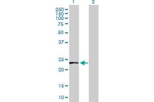 Western Blot analysis of HSPB8 expression in transfected 293T cell line by HSPB8 MaxPab polyclonal antibody.
