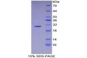 SDS-PAGE (SDS) image for Aconitase 1 (ACO1) (AA 26-189) protein (His tag) (ABIN1169743)