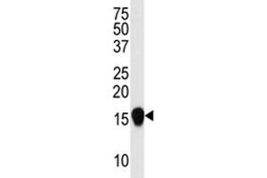 Western blot analysis of SUMO4 antibody (V55 Mutant) in HepG2 lysate.