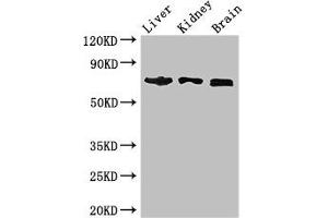 Western Blot Positive WB detected in: Mouse liver tissue, Mouse kidney tissue, Mouse brain tissue All lanes: TCF4 antibody at 2. (TCF4 anticorps  (AA 419-525))
