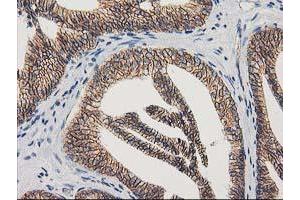 Image no. 11 for anti-Catenin (Cadherin-Associated Protein), beta 1, 88kDa (CTNNB1) antibody (ABIN1496889)