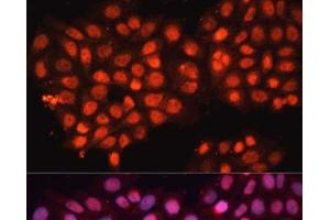 Immunofluorescence analysis of HeLa cells using ABCB8 Polyclonal Antibody at dilution of 1:100 (40x lens). (ABCB8 anticorps)