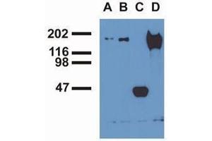 Western Blotting (WB) image for anti-Epidermal Growth Factor Receptor (EGFR) (pTyr1016) antibody (ABIN400878)
