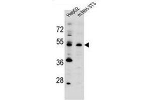Western blot analysis of KCMF1 antibody (C-term) Cat. (KCMF1 anticorps  (C-Term))