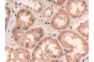 Detection of GHRH in Human Kidney Tissue using Polyclonal Antibody to Growth Hormone Releasing Hormone (GHRH)