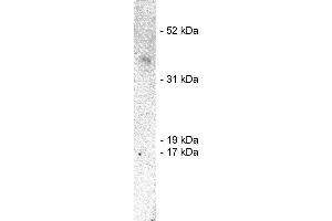 Western blot using  X1859P, rabbit polyclonal at 1  ug/ml on human brain lysate (20 ug/lane). (SIAH1 anticorps)