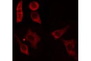 ABIN6279106 staining HepG2 cells by IF/ICC.