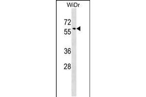 Western blot analysis in WiDr cell line lysates (35ug/lane). (SNX18 anticorps  (C-Term))