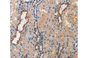 IHC-P analysis of kidney tissue, with DAB staining. (IGFBP6 anticorps  (AA 31-240))