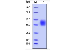 Mouse B7-H5, His Tag on  under reducing (R) condition. (VTCN1 Protein (AA 33-191) (His tag))