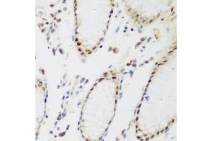 Immunohistochemistry of paraffin-embedded human stomach using PPAN antibody (ABIN5975126) at dilution of 1/200 (40x lens). (PPAN anticorps)
