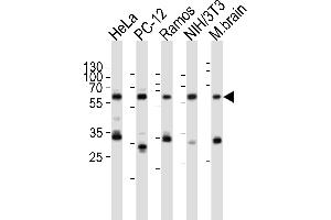 Western blot analysis of lysates from HeLa, rat PC-12, Ramos, mouse NIH/3T3 cell line, mouse brain tissue lysate(from left to right), using PKM2-N491 at 1:1000 at each lane.