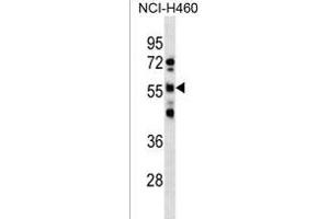 RBMY1D Antibody (C-term) (ABIN1537343 and ABIN2850417) western blot analysis in NCI- cell line lysates (35 μg/lane).