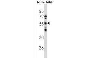RBMY1D Antibody (C-term) (ABIN1537343 and ABIN2850417) western blot analysis in NCI- cell line lysates (35 μg/lane). (RBMY1D anticorps  (C-Term))