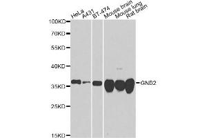 Western blot analysis of extracts of various cell lines, using GNB2 antibody.