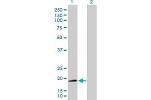 Western Blot analysis of NNT expression in transfected 293T cell line by NNT MaxPab polyclonal antibody. (NNT anticorps  (AA 1-207))
