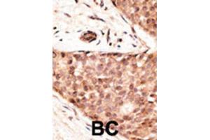 Immunohistochemistry (IHC) image for anti-Caudal Type Homeobox 2 (CDX2) antibody (ABIN3002517) (CDX2 anticorps)