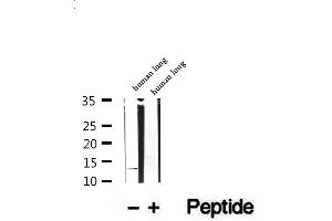 Western blot analysis of extracts of human lung tissue, using DNAJC19 antibody.