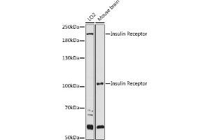 Western blot analysis of extracts of various cell lines, using Insulin Receptor antibody (ABIN3020883, ABIN3020884, ABIN3020885 and ABIN6213774) at 1:1000 dilution. (Insulin Receptor anticorps  (AA 1130-1230))