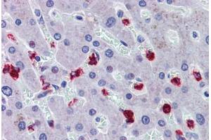 Liver, Human: Formalin-Fixed, Paraffin-Embedded (FFPE)