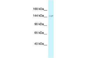 WB Suggested Anti-DHX38 Antibody Titration: 1. (DHX38 anticorps  (Middle Region))