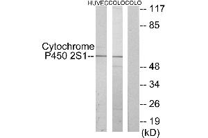 Immunohistochemistry analysis of paraffin-embedded human lung carcinoma tissue using Cytochrome P450 2S1 antibody.