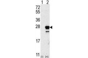 Western Blotting (WB) image for anti-GTPase NRas (NRAS) antibody (ABIN5023677) (GTPase NRas anticorps)