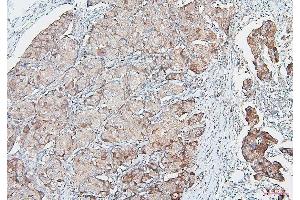 IHC analysis of COMT using anti-COMT antibody (ABIN7601948).