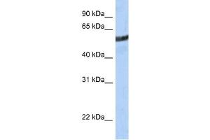 ME3 antibody used at 1 ug/ml to detect target protein. (ME3 anticorps)