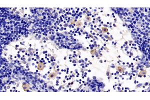 Detection of TLR5 in Rat Lymph node Tissue using Monoclonal Antibody to Toll Like Receptor 5 (TLR5)