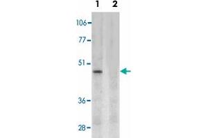 Western blot analysis of CD209 expression in human placenta tissue lysate in the absence (lane 1) and presence (lane 2) of blocking peptide with CD209 polyclonal antibody  at 2 ug /mL . (DC-SIGN/CD209 anticorps  (Internal Region))