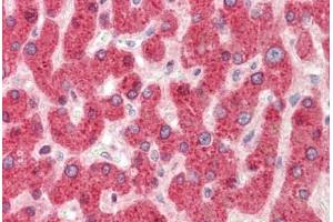 Human, Liver: Formalin-Fixed Paraffin-Embedded (FFPE)