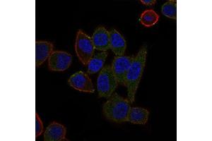 Immunocytochemistry (ICC) image for anti-ATP-Binding Cassette, Sub-Family B (MDR/TAP), Member 5 (ABCB5) (AA 481-674) antibody (ABIN1842667)