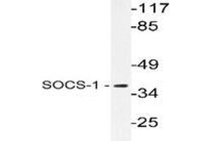 Western blot analysis of SOCS-1 in extracts from Jurkat cells using SOCS1 / JAB antibody . (SOCS1 anticorps)
