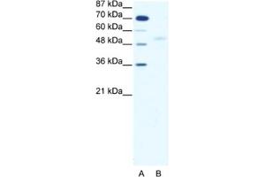 Western Blotting (WB) image for anti-SMAD, Mothers Against DPP Homolog 5 (SMAD5) antibody (ABIN2460352) (SMAD5 anticorps)