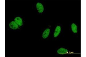 Immunofluorescence of monoclonal antibody to PHIP on HeLa cell. (PHIP anticorps  (AA 1599-1705))