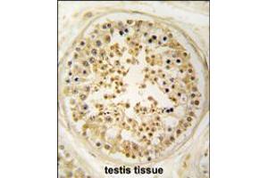 Formalin-fixed and paraffin-embedded human testis tissue reacted with EARS2 antibody , which was peroxidase-conjugated to the secondary antibody, followed by DAB staining. (EARS2 anticorps  (C-Term))