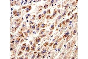 IHC analysis of FFPE human liver section using DHFR antibody; Ab was diluted at 1:25. (Dihydrofolate Reductase anticorps  (AA 1-50))