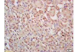 Formalin-fixed and paraffin embedded mouse kidney labeled with Rabbit Anti INTS3 Polyclonal Antibody, Unconjugated (ABIN1387357) at 1:200 followed by conjugation to the secondary antibody and DAB staining