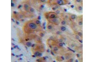 IHC-P analysis of Liver tissue, with DAB staining. (IL1R1 anticorps  (AA 20-338))