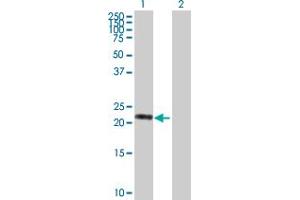 Western Blot analysis of VASH1 expression in transfected 293T cell line by VASH1 MaxPab polyclonal antibody. (VASH1 anticorps  (AA 1-204))