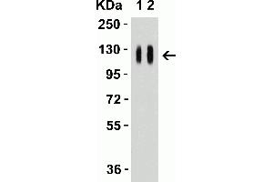 Western Blot Validation with SARS-CoV-2 (COVID-19) Spike S1 Recombinant Protein Loading: 50 ng per lane of SARS-CoV-2 (COVID-19) Spike S1 recombinant protein (97-087).