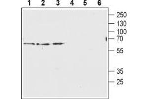 Western blot analysis of rat brain membranes (lanes 1 and 4), mouse brain membranes (lanes 2 and 5) and human U-87 MG glyoblastoma lysates (lanes 3 and 6): - 1-3. (SLC32A1 anticorps  (Cytosolic, N-Term))