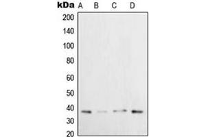 Western blot analysis of XRCC3 expression in HeLa (A), H1299 (B), U2OS (C), HepG2 (D) whole cell lysates. (XRCC3 anticorps  (Center))