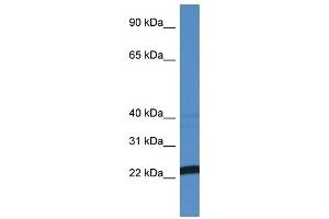 Western Blot showing EFNA4 antibody used at a concentration of 1 ug/ml against MCF7 Cell Lysate
