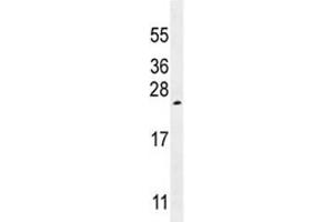 VEGF-A antibody western blot analysis in K562 lysate.