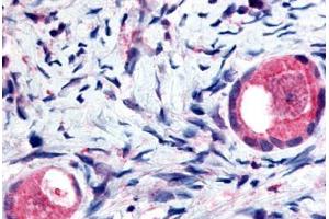 Human Ovary, Oocytes (formalin-fixed, paraffin-embedded) stained with TMEM5 antibody ABIN213420 at 5 ug/ml followed by biotinylated goat anti-rabbit IgG secondary antibody ABIN481713, alkaline phosphatase-streptavidin and chromogen. (TMEM5 anticorps  (Extracellular Domain))